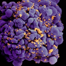 H9 T cell infected by HIV
