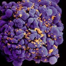 H9 T cell infected by HIV